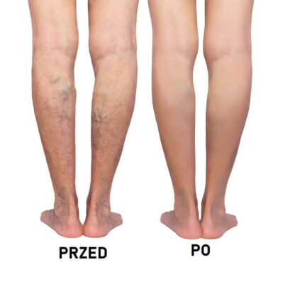 Maść żmijowa rozgrzewająca przeciwbólowa 500 ml - obrazek 3